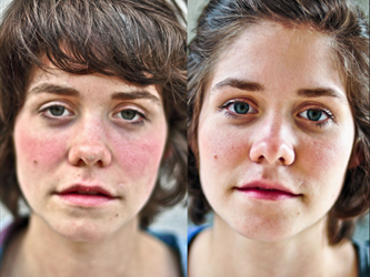 Left is no sleep Right is with sleep